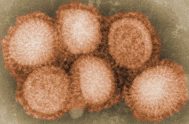 1957-1958 एशियाई फ्लू महामारी इन्फ्लूएंजा 1957–1958 influenza pandemic