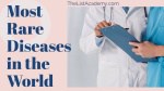 177 Most Rarest Diseases in the World -thelistAcademy