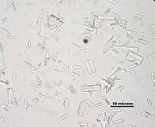 Struvite